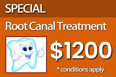 Root canal promotion